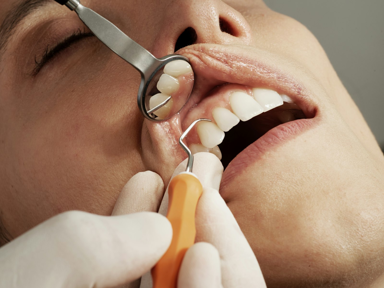Auckland dental group — 62 new patients / mo, 4.9★ across 3 locations
